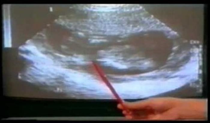 Proietta film sull'aborto: sospeso prof di religione