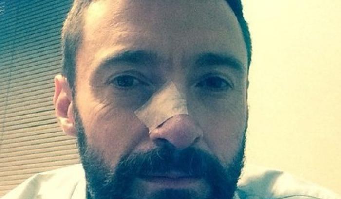 Hugh Jackman: sono stato operato di cancro