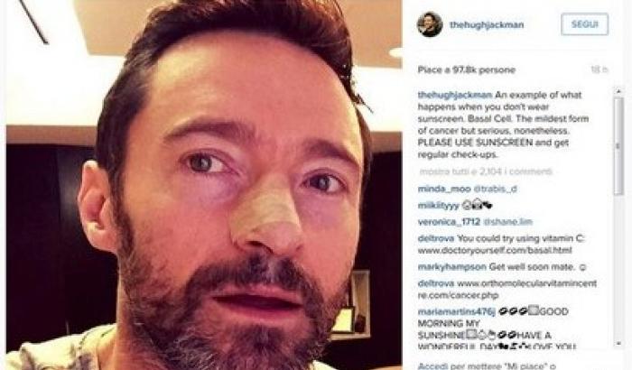 Operato per un tumore, Hugh Jackman ai fan: usate la crema solare