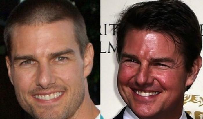 Tom Cruise e quel botox in più: da Top Gun al Gobbo di Notre Dame