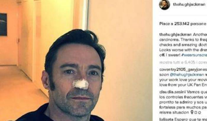 Hugh Jackman operato per un tumore: "Usate la crema solare"