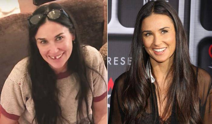 Demi Moore mostra una sua foto senza denti: "Li ho persi per lo stress"