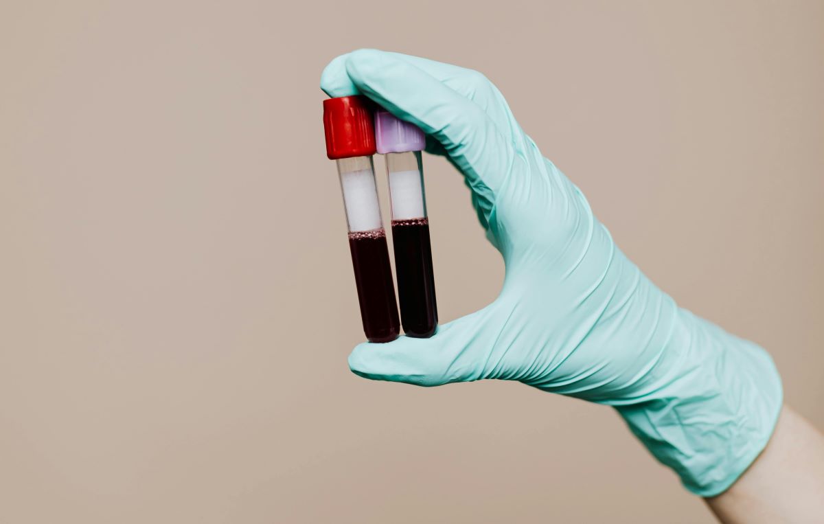 Un'analisi del sangue per calcolare l'età biologica dei nostri organi