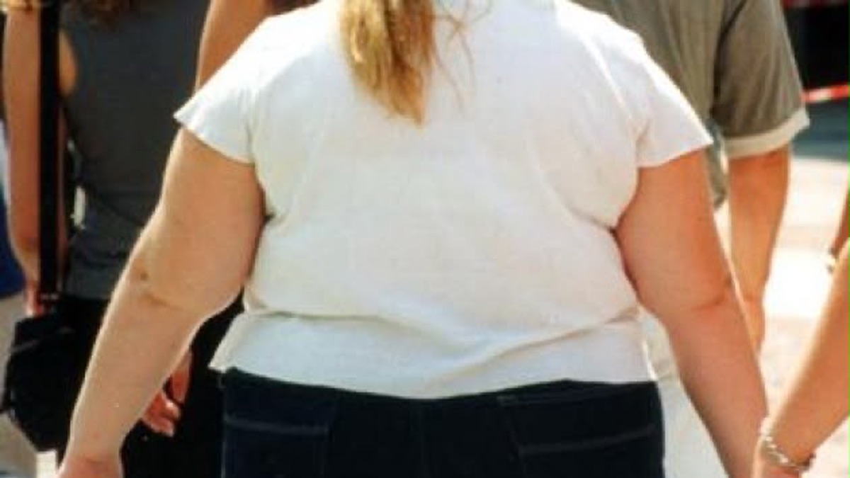 Obesit&agrave; in adolescenza, cambiano le cure: &egrave; una malattia cronica